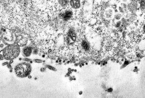 Бразильцы запечатлели момент заражения клетки вирусом SARS-CoV-2