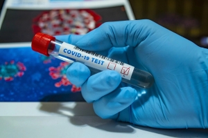 Роспотребнадзор представил ПЦР-тест на коронавирус, который даёт результат за час